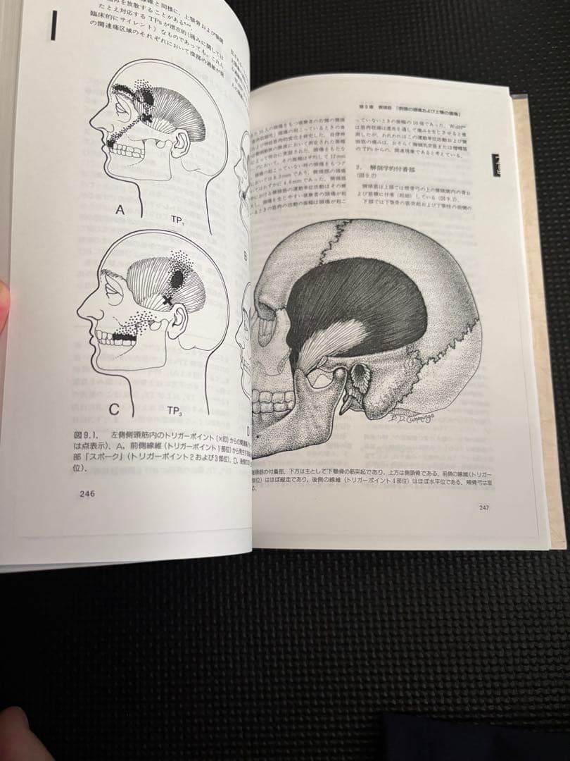 トリガーポイントマニュアル　筋膜痛と機能障害　第一巻　頭頸部編　値上げ予定