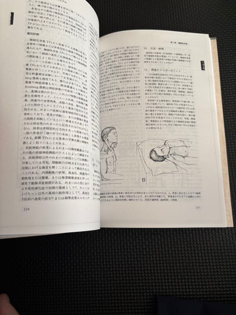 トリガーポイントマニュアル　筋膜痛と機能障害　第一巻　頭頸部編　値上げ予定