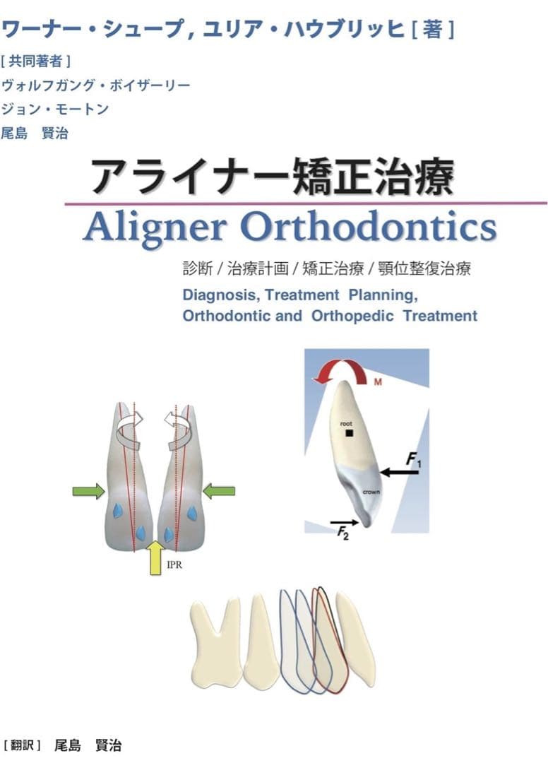 裁断済み アライナー矯正治療 診断/治療計画/矯正治療/顎位整復治療