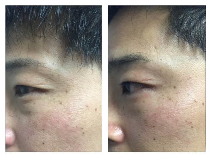 wLUファンスクリーム