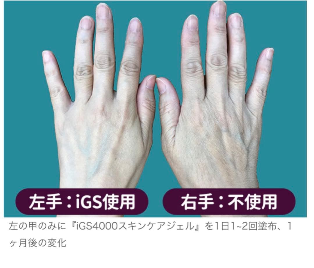 フェイスジェル・ゲル iGS 4000 Gel 100g