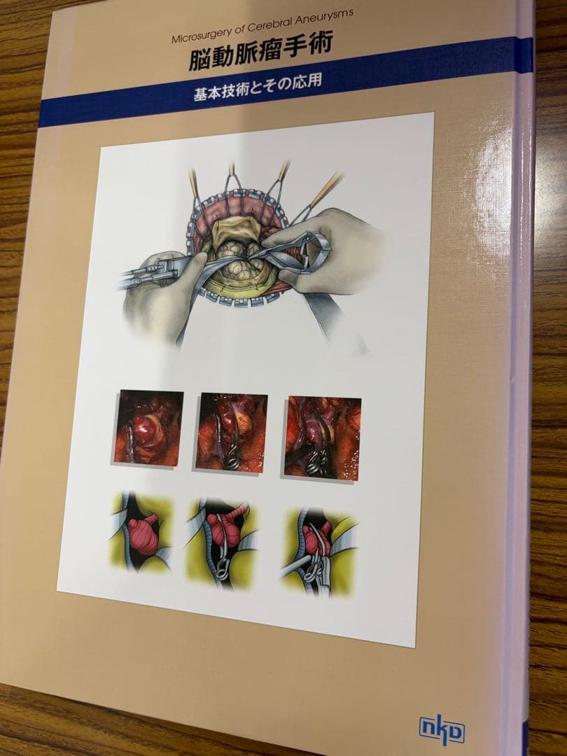 脳動脈瘤手術　基本手術とその応用　上山博康