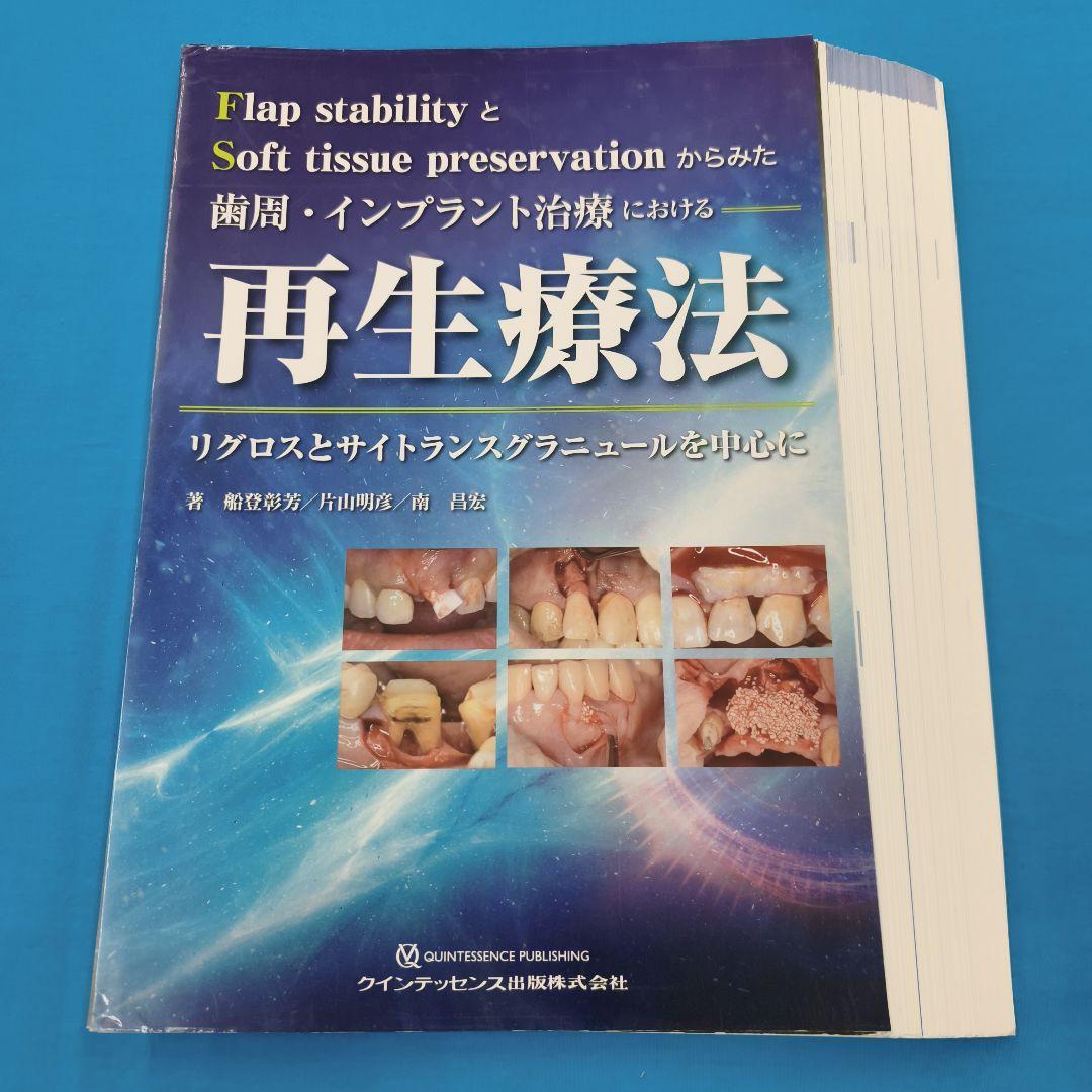 ♣裁断済 再生療法 - 歯周・インプラント治療