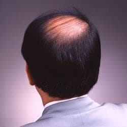 ワンタッチグローEX+4 200g【6本セット】☆おまけ付き