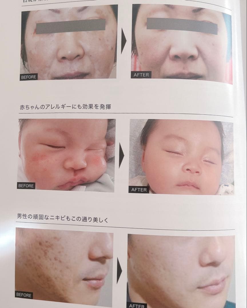 MONNALI TR50シリーズセット