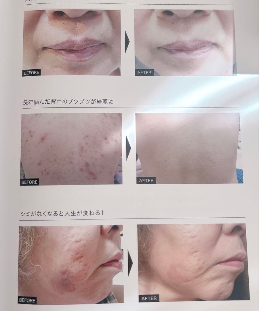 MONNALI TR50シリーズセット