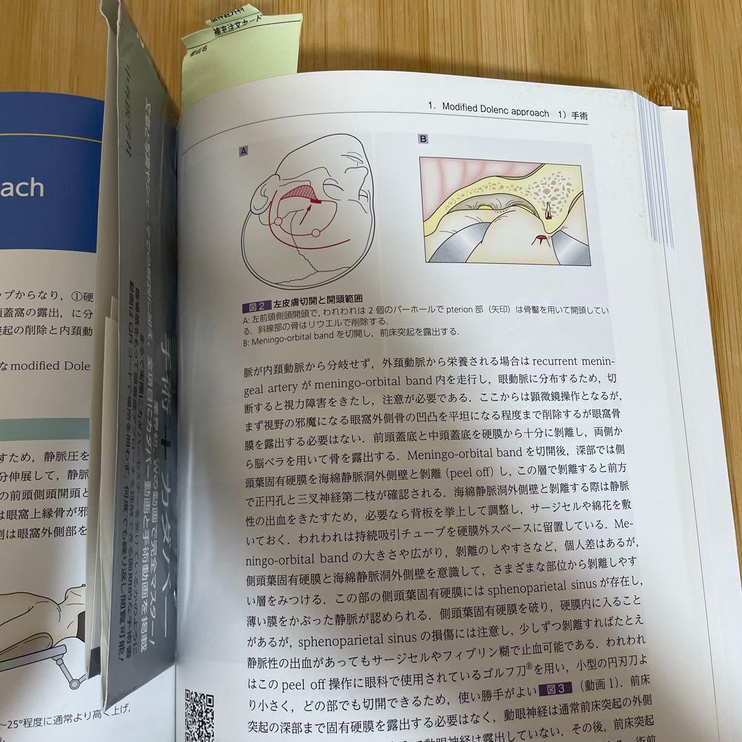 カダバーと動画で学ぶ頭蓋底アプローチ