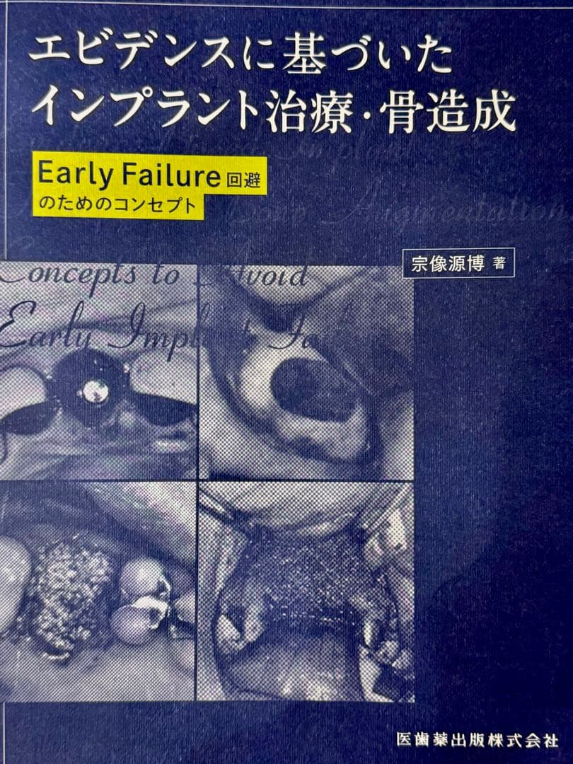 【裁断本】エビデンスに基づいたインプラント治療・骨造成
