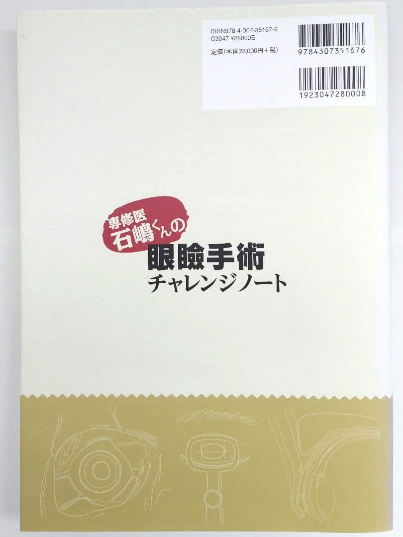 眼瞼手術チャレンジノート