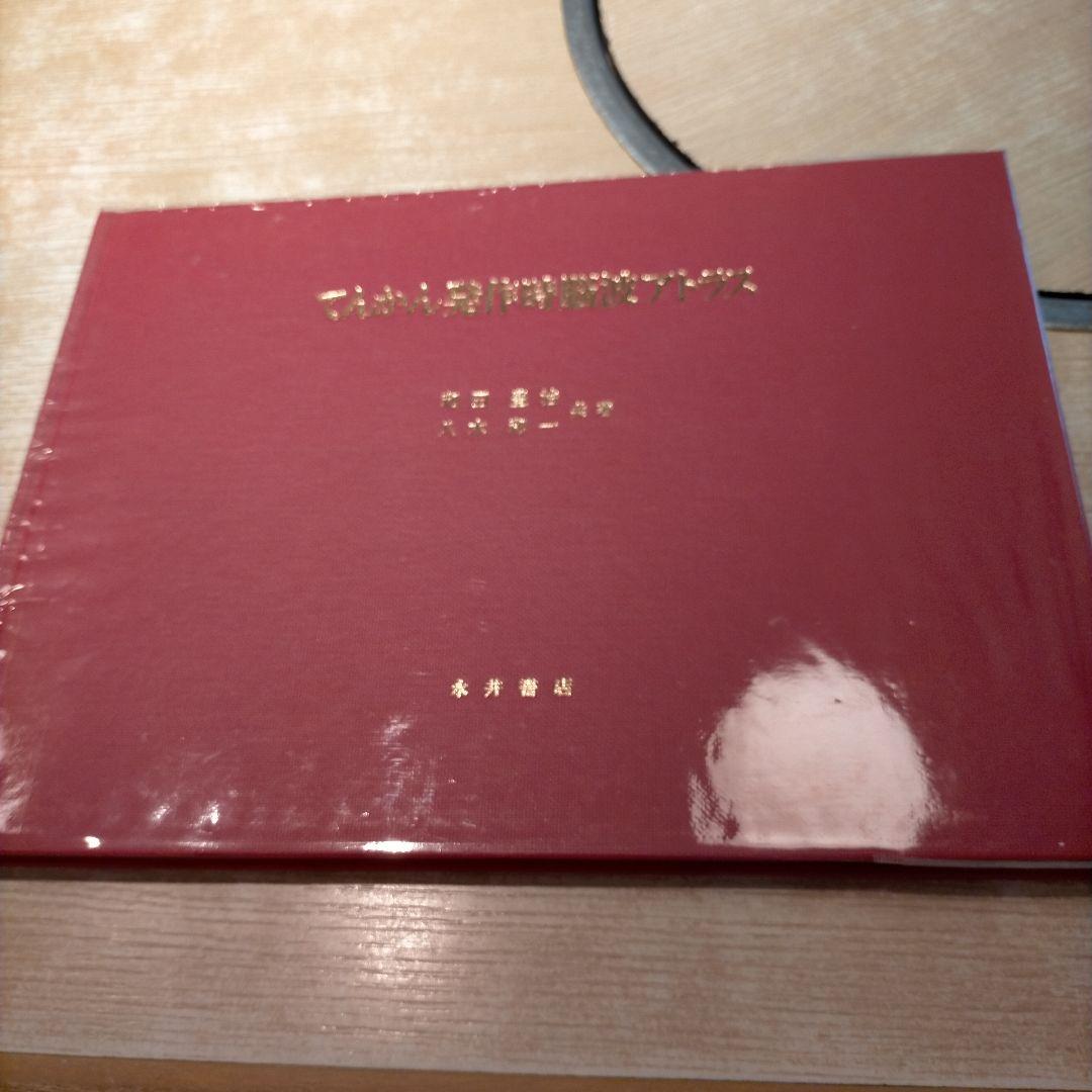 【 稀少 】てんかん発作時脳波アトラス 1987年発行