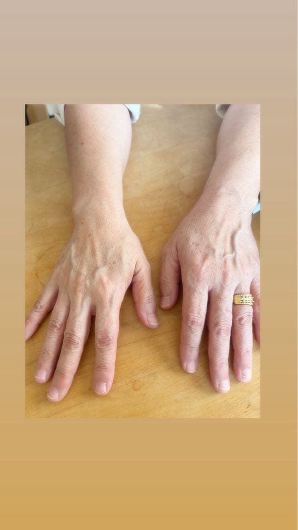 シグナルローション100ml ２本セット