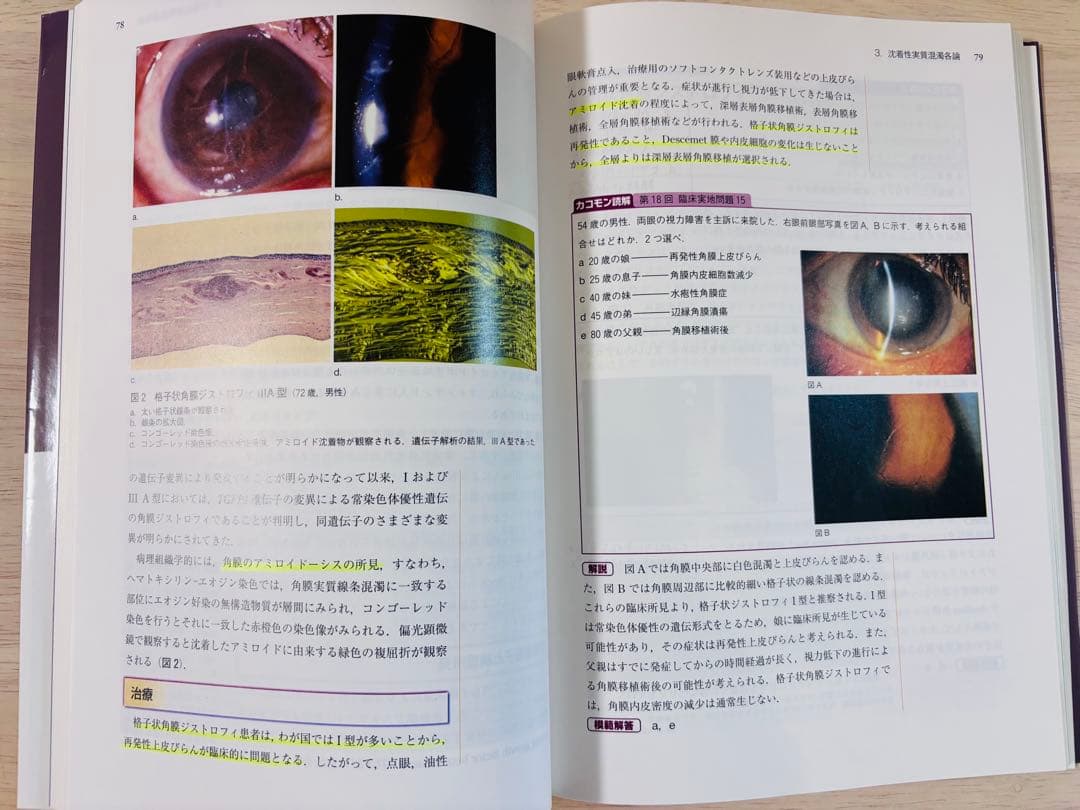 【書き込み少】眼科診療クオリファイ 25 角膜混濁のすべて
