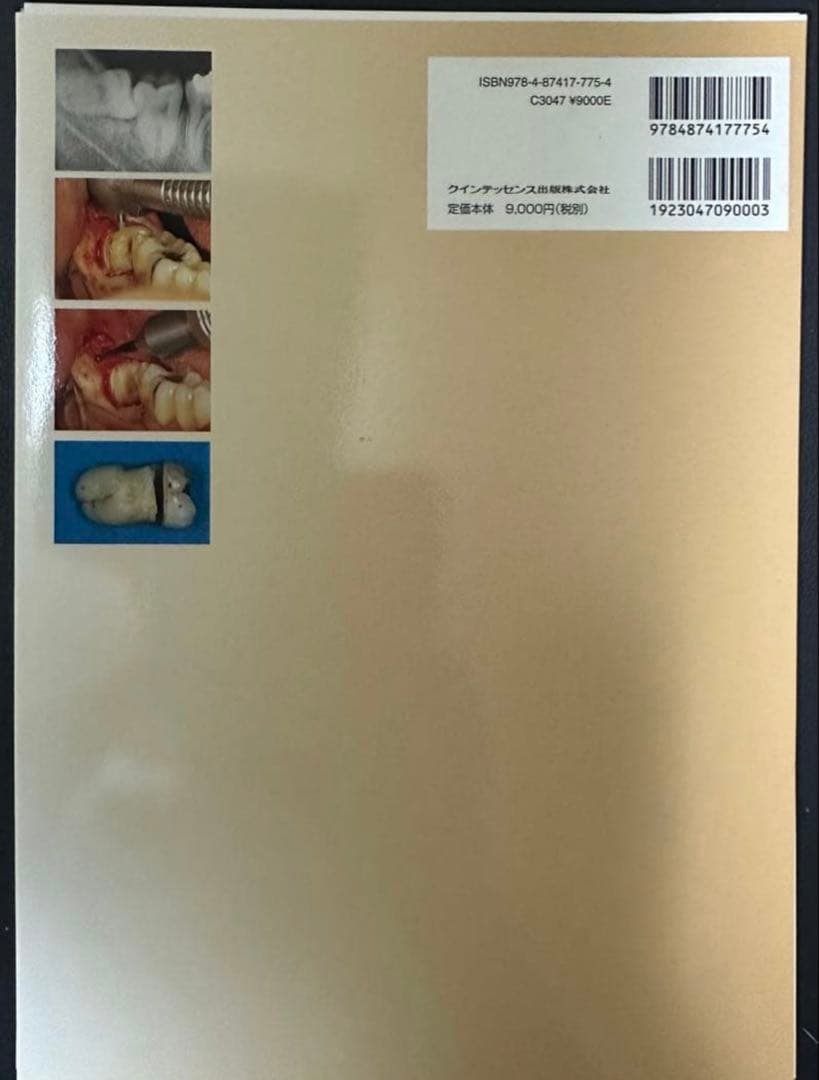 智歯の抜歯ナビゲーション