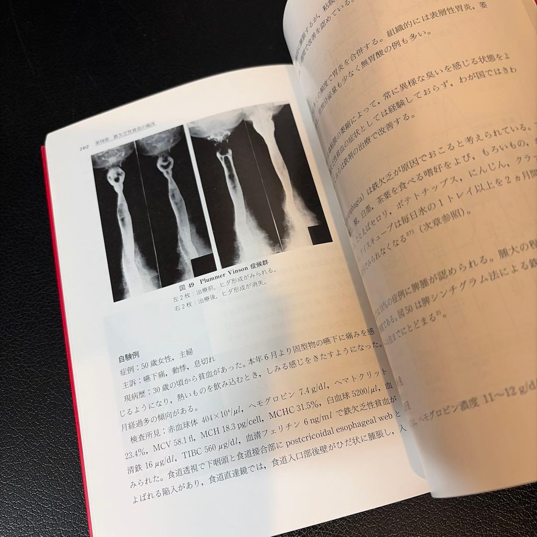 鉄欠乏性貧血 一鉄の基礎と臨床