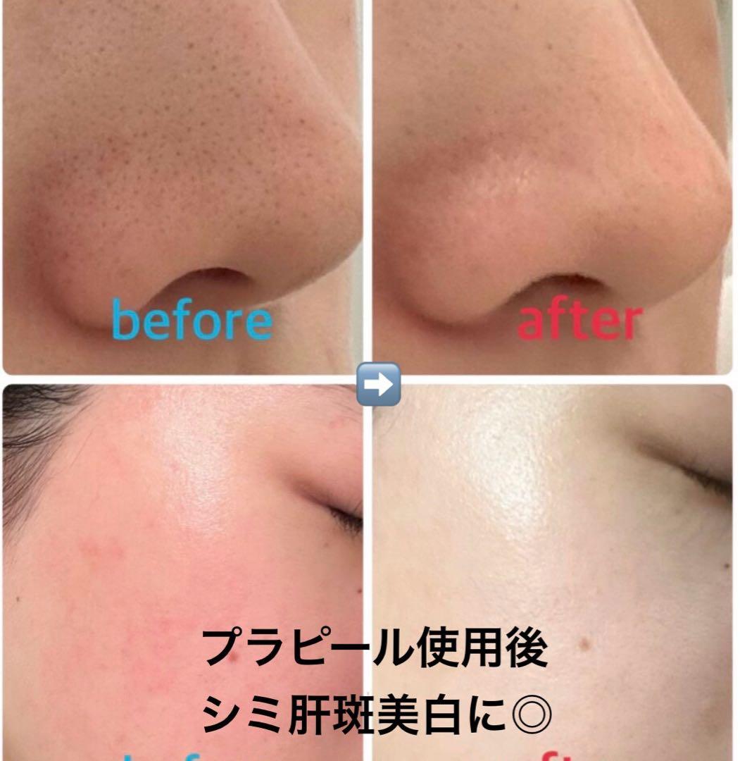 複数特割☆【ララピール進化版プラピール】3セット×9回分→14,400円