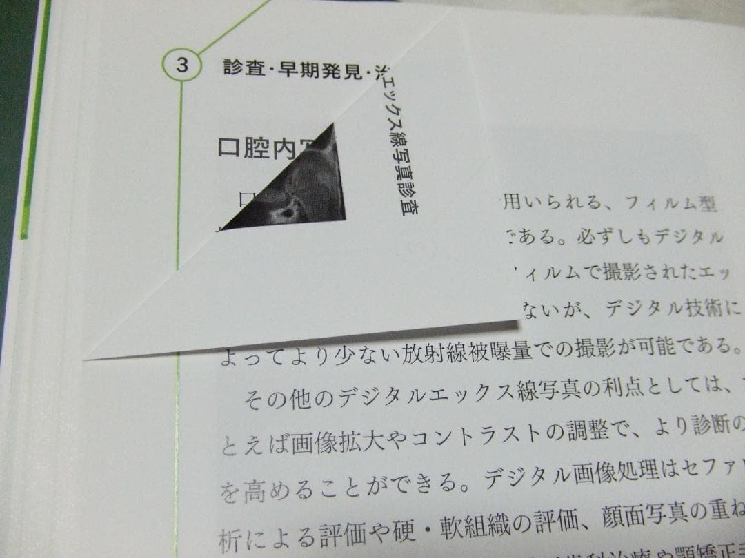 早期治療 成長発育のエビデンスと治療戦略 矯正 歯列矯正 歯科